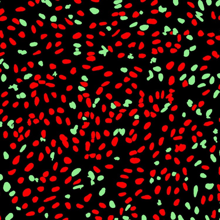 Masque d’altération de l’ADN dans des cellules U2OS avec le système ImageXpress Nano