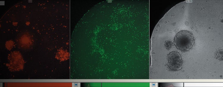 Cellules T (lymphocytes T) et canal LT