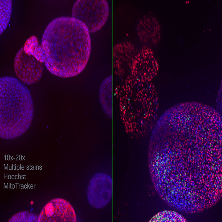 Noyaux utilisant le colorant phalloïdine à 60X avec le système ImageXpress Nano