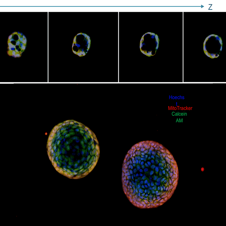 Superposition d’altérations de l’ADN dans des cellules U2OS avec le système ImageXpress Nano