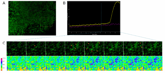 Imagerie calcique d’organoïdes cérébraux pour déterminer l’activité neuronale