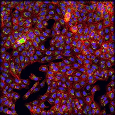 Cellules traitées avec de la chloroquine