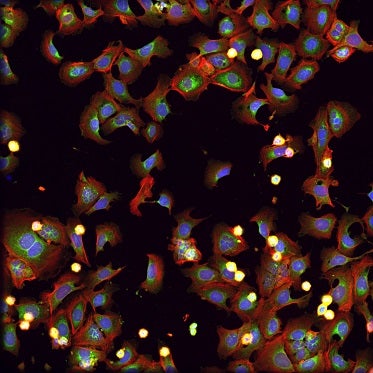 Cellules traitées avec de la roténone, une toxine fréquemment utilisée dans les insecticides