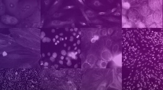 Recursion produit le plus grand ensemble accessible au public de données morphologiques cellulaires humaines pour la recherche sur le traitement de la COVID-19