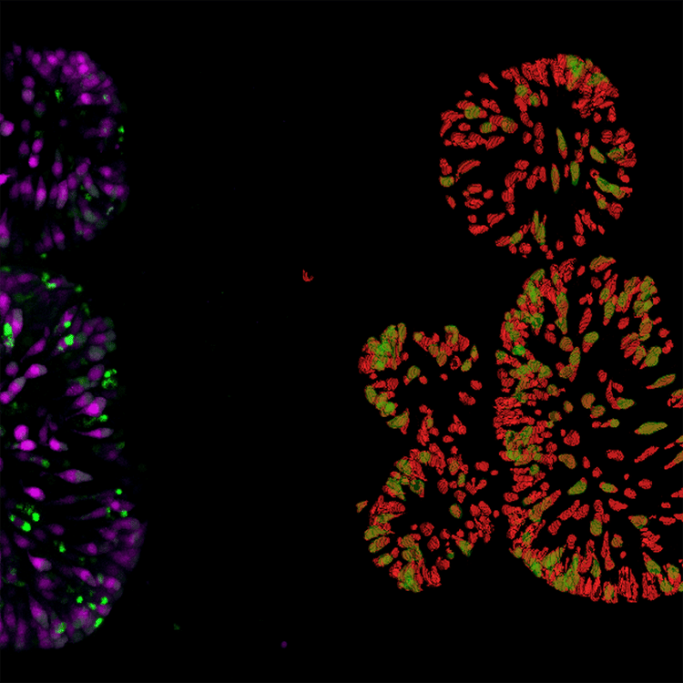 Organoïde intestinal de cellules rouge tomate Détection d’un double positif (mNeon) en vert