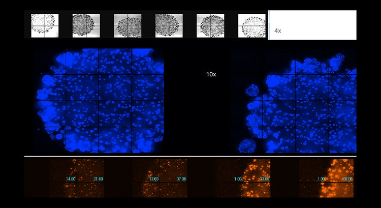 Masque de tracés de neurites assemblés à 40X avec le système ImageXpress Nano