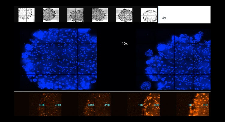 Imagerie automatisée d’organoïdes vivants dans du Matrigel, grossissement 4x ou 10x