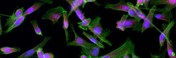 Imagerie et analyse cellulaires