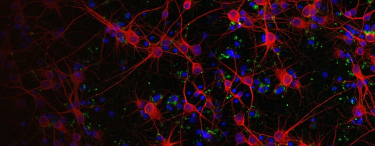 Excroissance des neurites