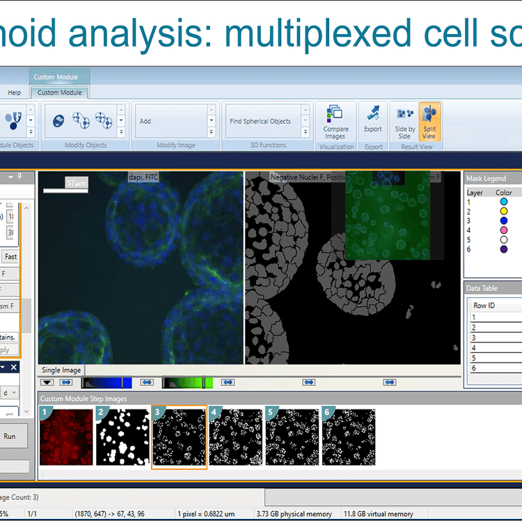 Cell Scoring multiplexé  d’analyse d’organoïdes