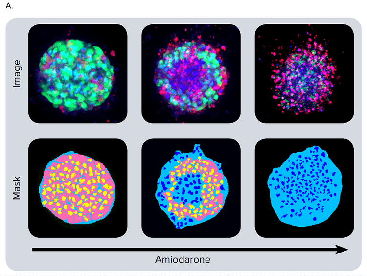 Phenotypic changes in the spheroids after compound treatment