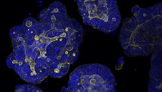 Understanding organoid morphology: a study to assess organoid size and cell count from 3D…