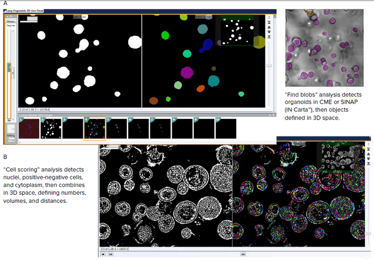 Image analysis recapture complexity of organoid structures using 3D image analysis