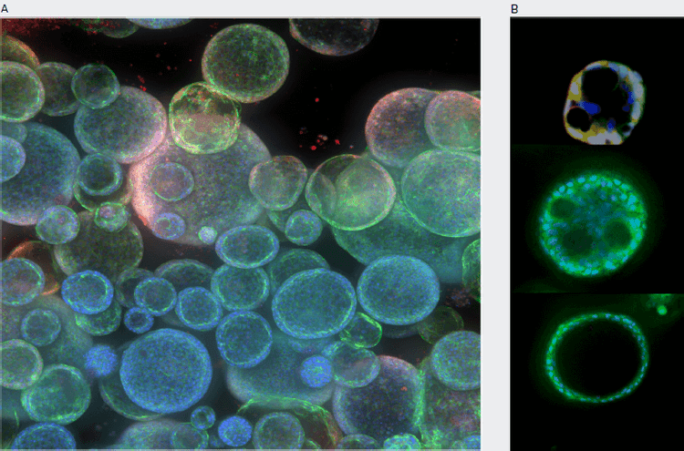 Monitoring complexity of organoid structure using confocal imaging