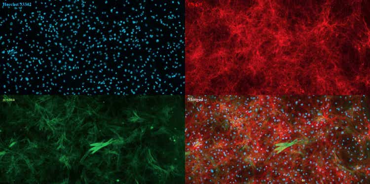 Images acquises avec le système d’imagerie cellulaire automatisé ImageXpress Pico de fibroblastes dermiques en culture isolés de la peau de vache. Noyaux (bleu), collagène (rouge), actine alpha du muscle lisse (vert)