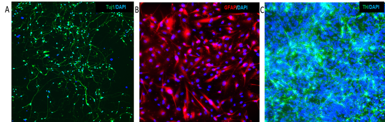 Dérivés d’iPSC : Tuj1, GFAP et TH avec des noyaux contre-colorés avec DAPI