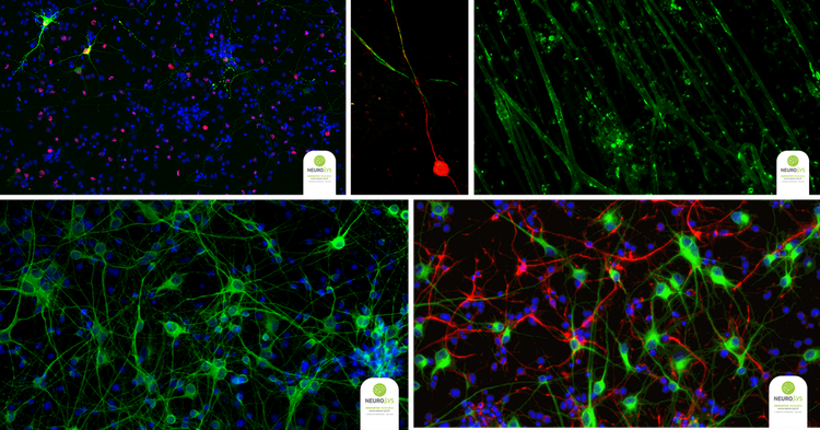 Jonctions neuromusculaires, cinétique de la myélinisation et prolifération des cellules gliales