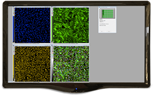 Logiciel d’analyse d’images MetaXpress