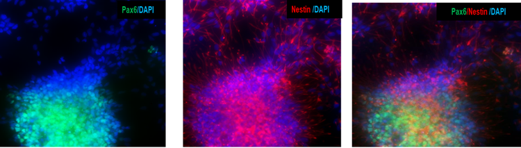 Les cellules progénitrices neurales dérivées d’iPSC expriment les marqueurs des progéniteurs neuraux PAX6 et Nestin