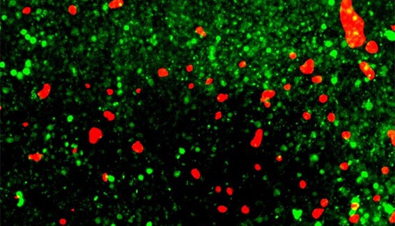 3D neurospheres assembled using iPSC-derived neurons and astrocytes