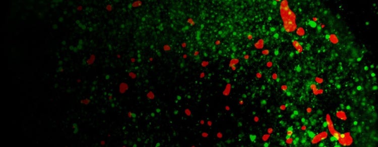 3D neurospheres