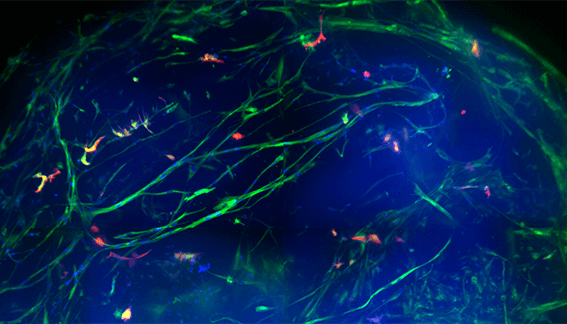 Neural outgrowth analysis in 3D human brain micro-tissues for compound screening…