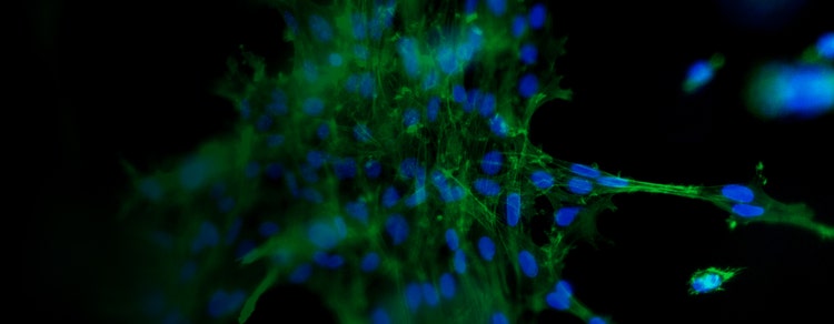 3D Model Drug Screening