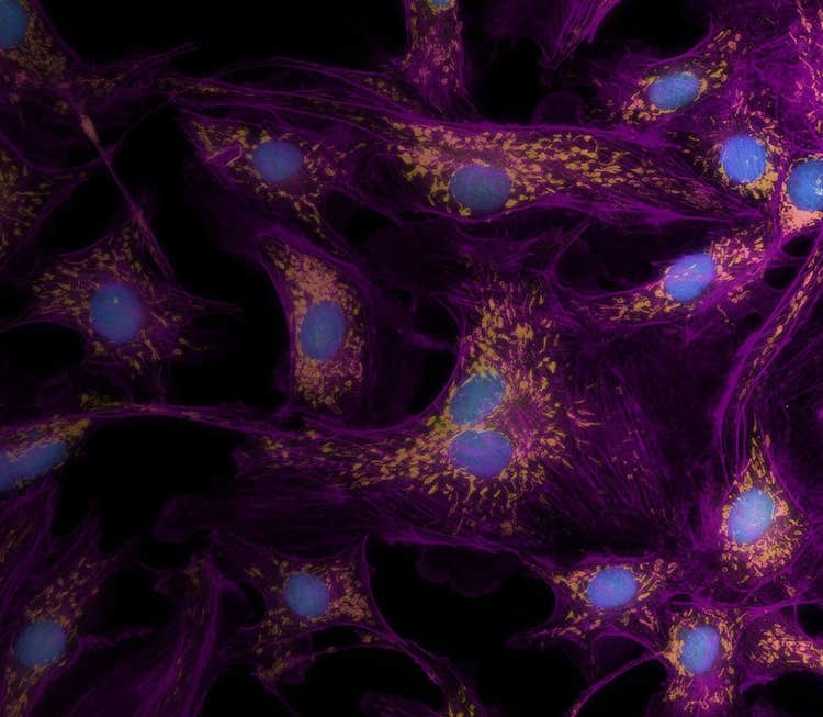 3D Bioprinting