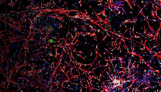 Neurite outgrowth analysis in 3D reconstructed human brain micro-tissues