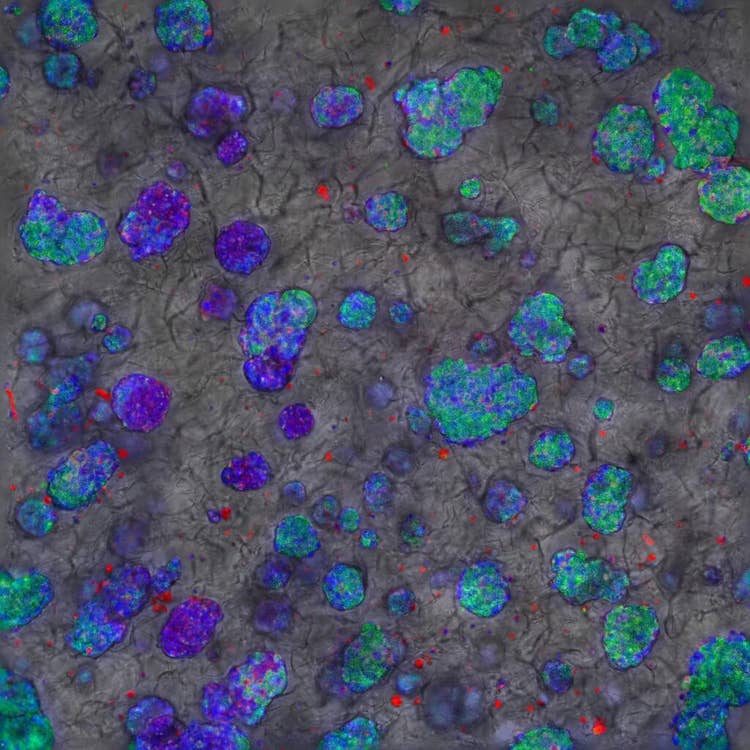 3D in vitro models