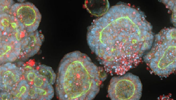 3D Organoids vs 2D Cell Lines