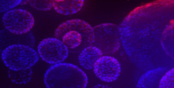 Organoïdes (3D) micro-tissus multicellulaires