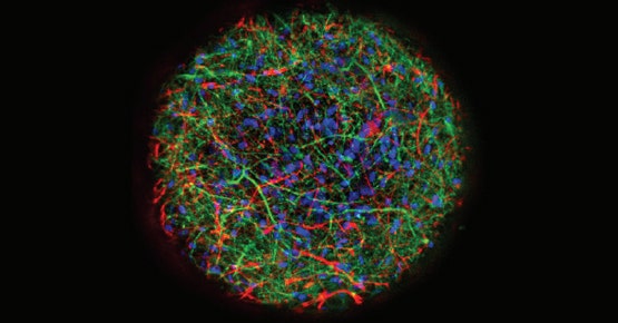 Oscillation calcique dans des sphéroïdes neuronaux 3D