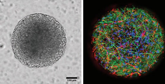 3D Neurospheroids, Neuronal Spheroids