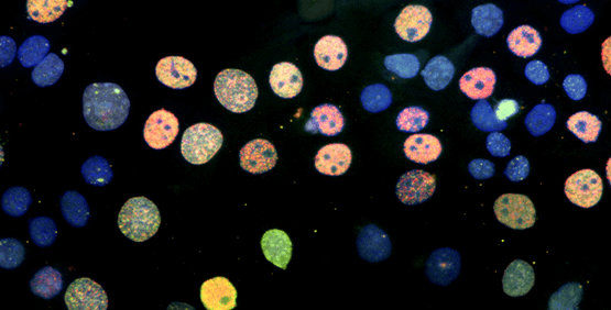 Études au niveau infra-cellulaire