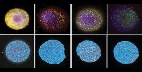 Sphéroïdes neuronaux 3D formés avec des cellules dérivées d’iPSC humaines