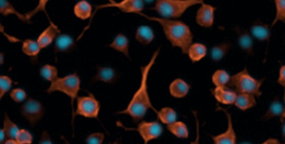 Analyse de l’excroissance des neurites