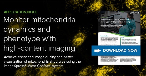 Surveillance de la dynamique et du phénotype des mitochondries grâce à HCI