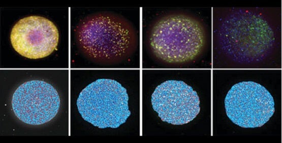 Neurotoxicité, toxicité neuronale