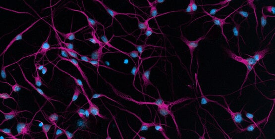 Cellules souches pluripotentes induites (iPSC)