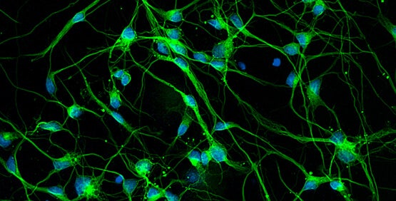 Morphologie neuronale