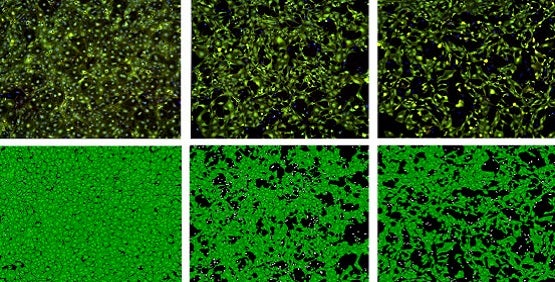 Cellules souches différenciées en cardiomyocytes