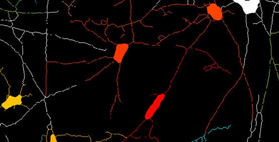 Excroissance des neurites / Tracé des neurites