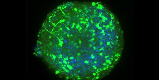 Neurodegenerative Disease Research