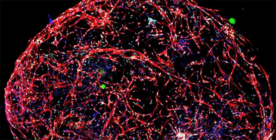 Micro-tissus cérébraux