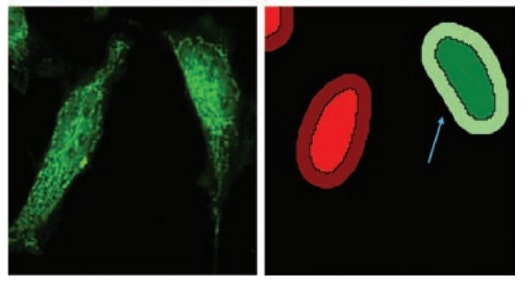 Améliorez les résultats des tests de translocation nucléaire grâce à la déconvolution des images