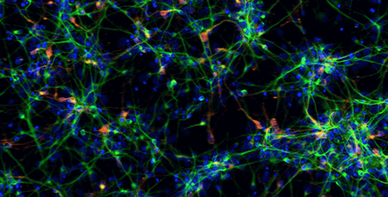 Les plasmides à l’origine de découvertes de cellules souches essentielles