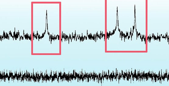 Moteur de détection des événements qui analyse les potentiels d’action spontanés et évoqués et les données post-synaptiques