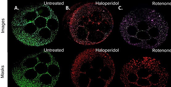 Modèles hépatiques imprimés en 3D à l’aide d’un dispositif robotisé multi-outils avec manipulation de liquides