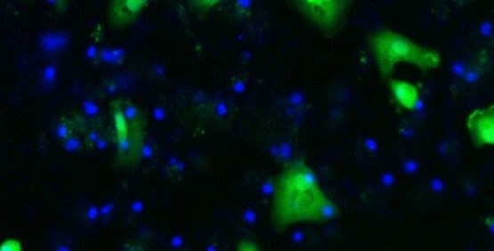 Cellules souches différenciées en hépatocytes